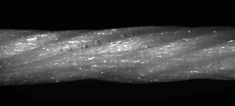 ligament artificiel